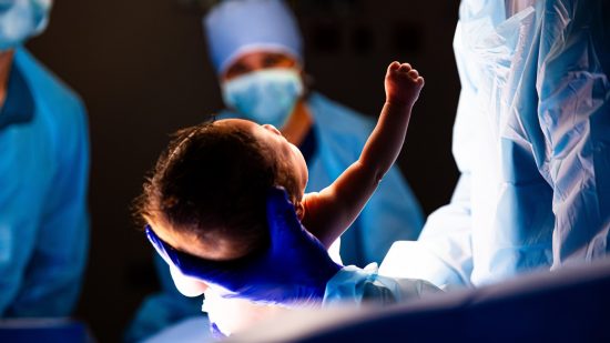 Behind the breakthrough: why uterus transplants need global insight